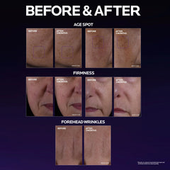 Mela B3 Double Dose Discoloration Treatment with Melasyl™